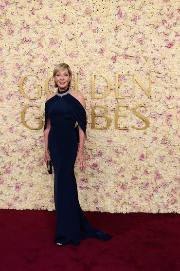 allison janney golden globes dress Allison Janney Off-the-shoulder Mermaid Dress With Sleeves 2019 Golden Globes TCD8243